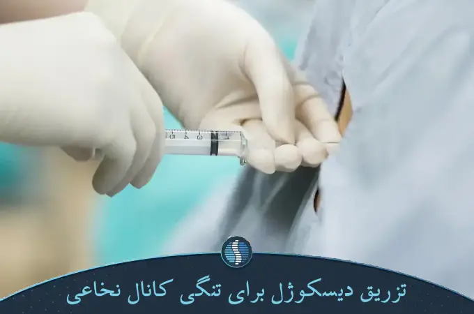 تزریق دیسکوژل برای تنگی کانال نخاعی