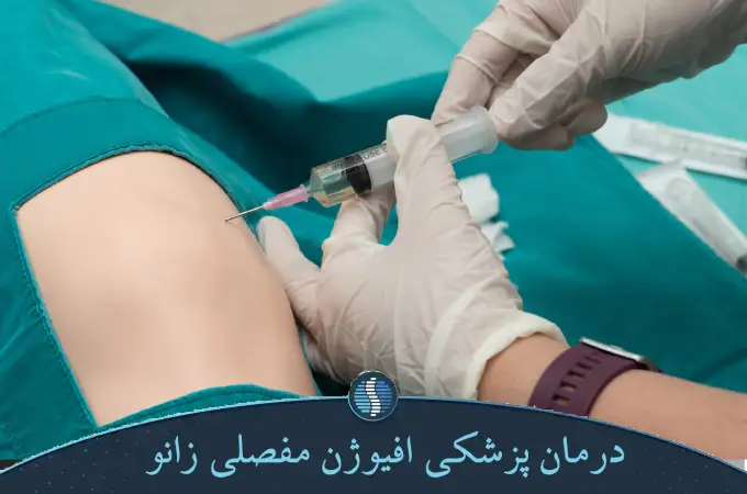 درمان پزشکی افیوژن مفصلی زانو