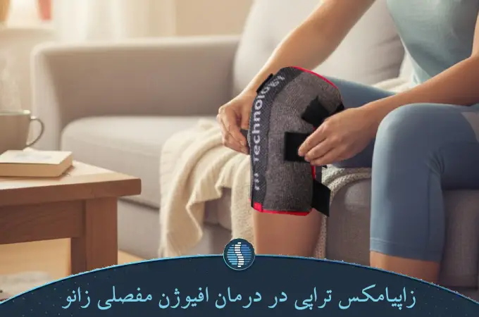 زاپیامکس تراپی در درمان افیوژن مفصلی زانو