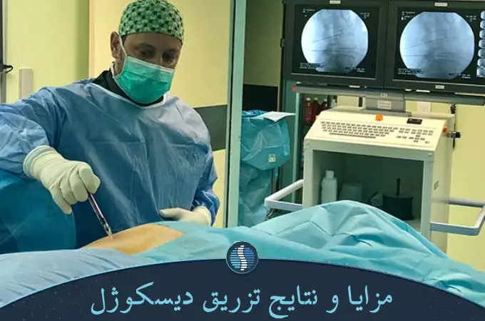 مزایا و نتایج تزریق دیسکوژل