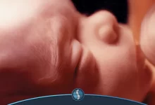 رشد چشم‌های جنین در رحم مادر| ژین طب