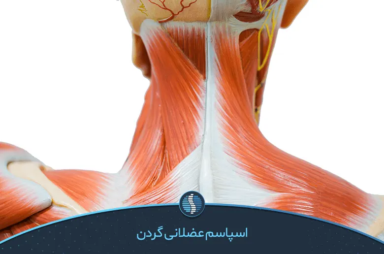اسپاسم عضلانی گردن-ژین طب