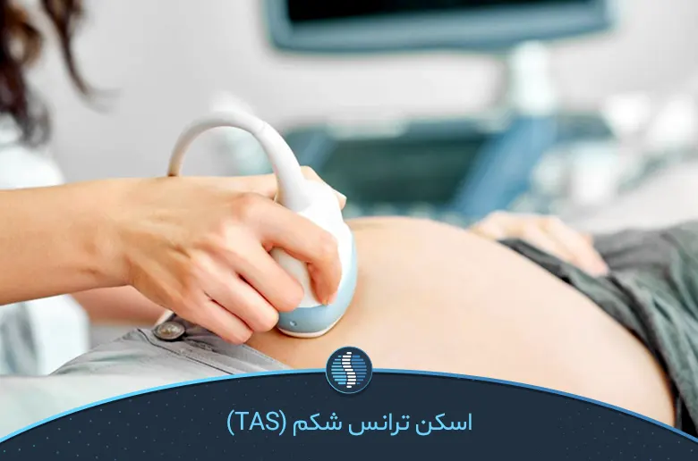 اسکن ترانس شکم (TAS)- ژین طب