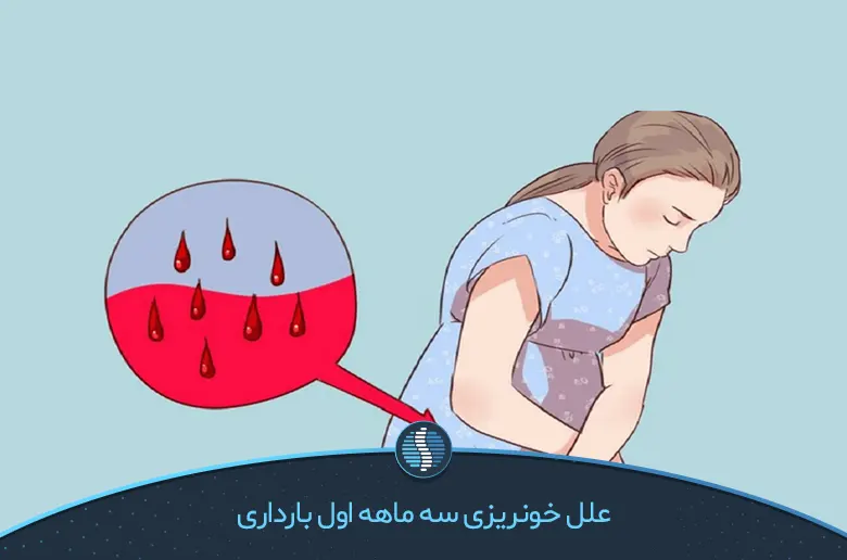 علل خونریزی سه ماهه اول بارداری-ژین طب
