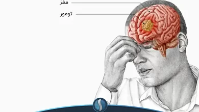 در تومور مغزی کجای سردرد میگیرد|ژین طب