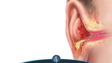 عفونت گوش | ژین طب