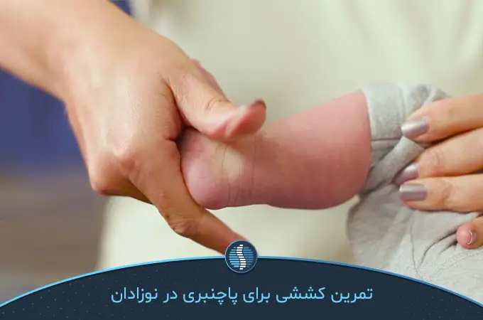 تمرین کششی برای درمان پاچنبری نوزاد|ژین طب