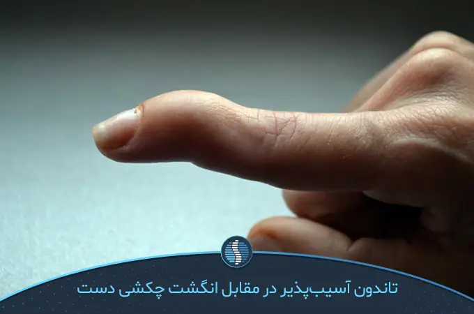 انگشت چکشی دست، باعث کاهش حرکت دست می شود | ژین طب