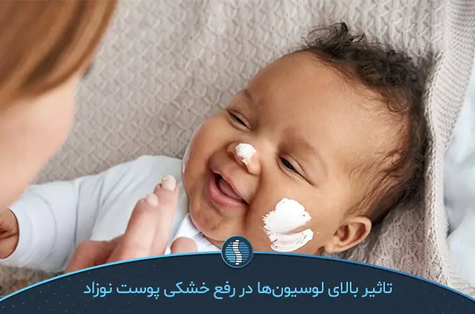 درمان خشکی پوست نوزاد با کرم های مختلف|ژین طب