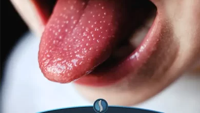 یکی از علائم بیماری کاوازاکی زبان توت فرنگی است | ژین طب