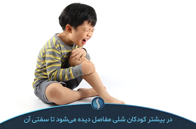 3-رشد نامناسب و بدشکلی مفاصل و استخوان‌ها به دلیل آرتریت نوجوانان که علت اصلی سفتی مفاصل کودکان است