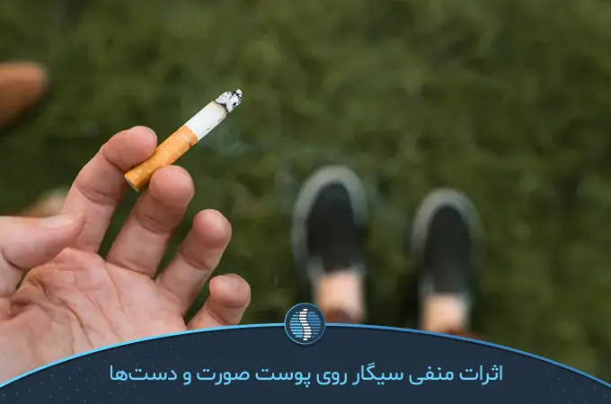 علت چروک دست گاهی مصرف زیاد سیگار است|ژین طب