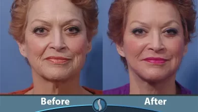 تصویر قبل و بعد چهره بعد از استفاده از بهترین مولتی ویتامین برای پوست و مو| ژین طب