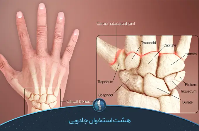 آرتروسکوپی مچ دست و تصویر انگشتان | ژین طب