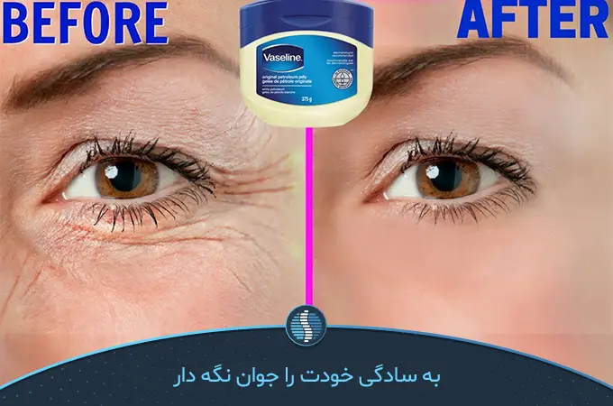 چهره‌ای قبل و بعد استفاده از وازلین برای چروک پوست و خط خنده| ژین طب