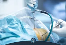 مراقبت های بعد از عمل آرتروسکوپی زانو | ژین طب