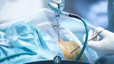 مراقبت های بعد از عمل آرتروسکوپی زانو | ژین طب