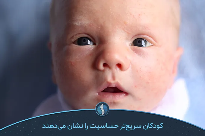 دون دون شدن پوست یکی از علائم حساسیت نوزاد به مولتی ویتامین است|ژین طب