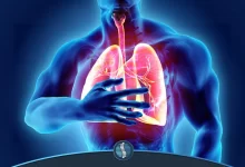 آمبولی ریه چیست؟
