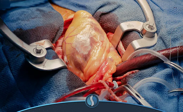 عمل قلب باز یک جراحی برای ترمیم قلب|ژین طب