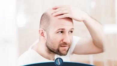 فردی که دنبال راهکاری برای جلوگیری از ریزش مو های خود است | ژین طب