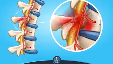عفونت دیسک کمر مسبب ایجاد درد و التهاب در ستون فقرات | ژین طب
