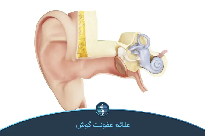 علائم عفونت گوش | ژین طب