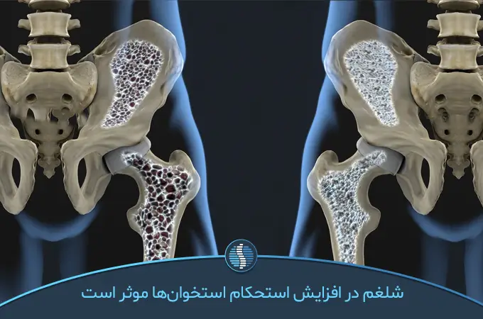 شلغم در افزایش استحکام استخوان‌ها موثر است | ژین طب