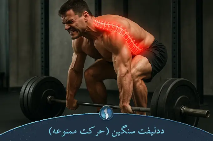 ددلیفت سنگین (حرکت ممنوعه)