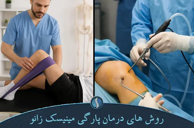 روش های درمان پارگی مینیسک زانو