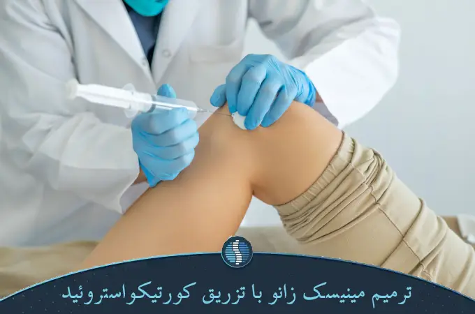 ترمیم مینیسک زانو با تزریق کورتیکواستروئید