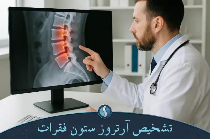 تشخیص آرتروز ستون فقرات