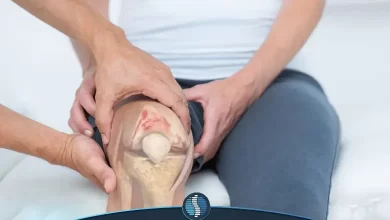 درمان خانگی آرتروز زانو