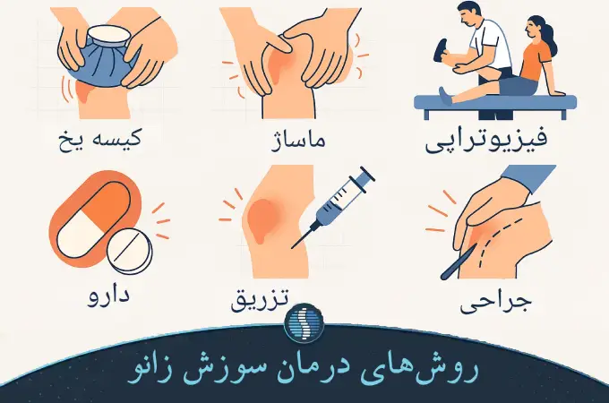 روش های درمان سوزش زانو