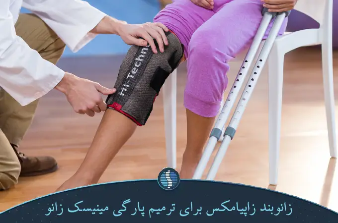 زانوبند زاپیامکس برای ترمیم پارگی مینیسک زانو