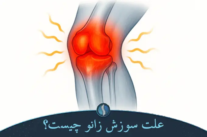 علت سوزش زانو چیست