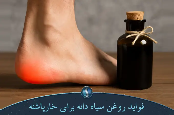 فواید روغن سیاه دانه برای خارپاشنه