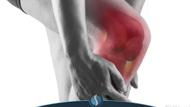 افیوژن مفصلی زانو