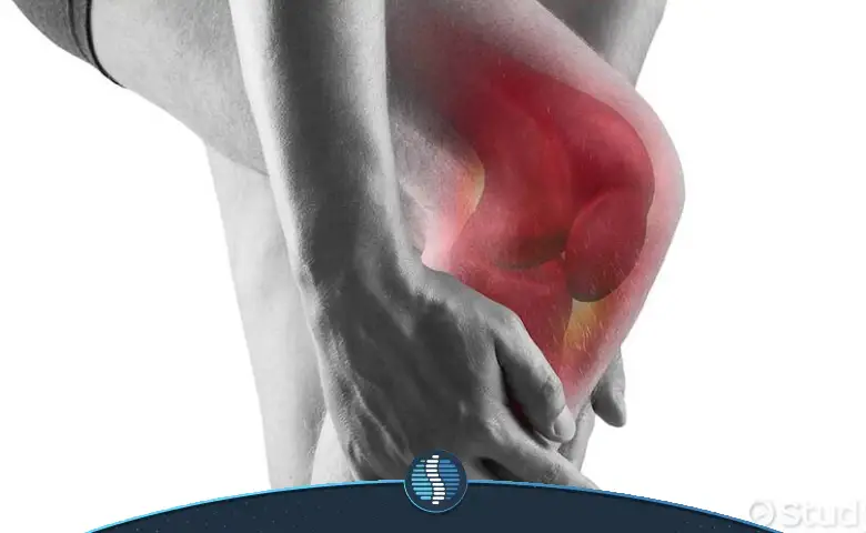 افیوژن مفصلی زانو